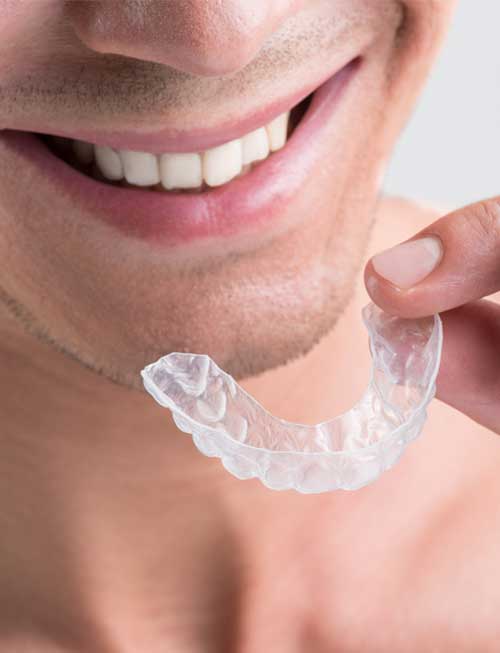 How Much Does Invisalign Cost in Redwood City?